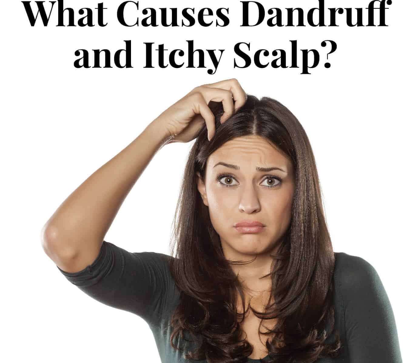 What Causes Dandruff and Itchy Scalp?