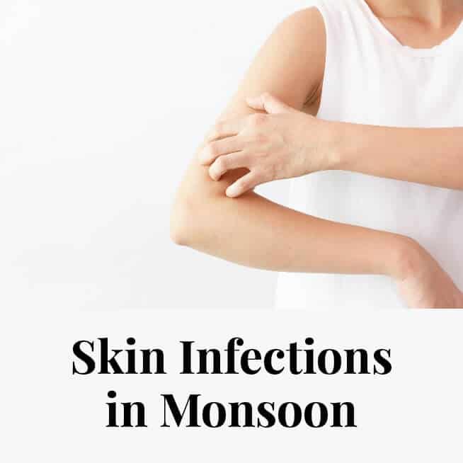 Skin Infections in Monsoon